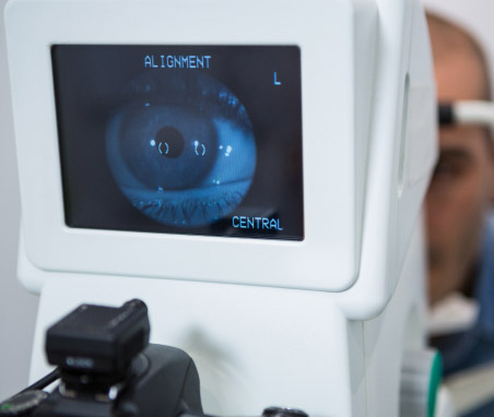 인공수정체 공막고정술